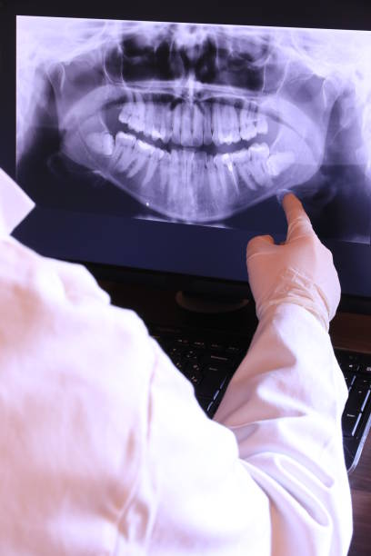 Best Emergency Root Canal Treatment in Granger, WA