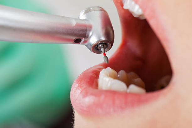 Best Pediatric Emergency Dentist in Granger, WA